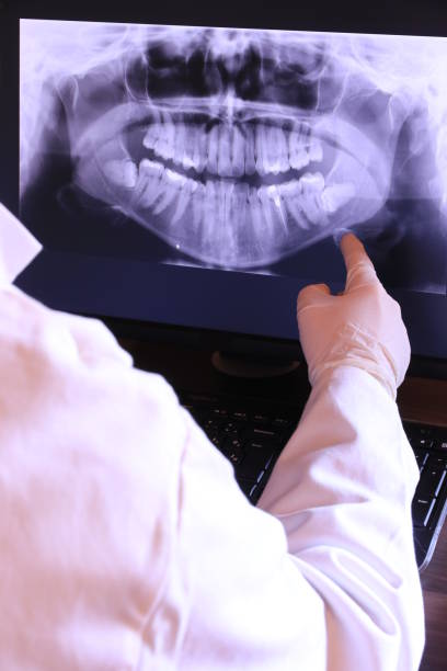 Best Chipped Tooth Repair Near Me  in Morganton, NC
