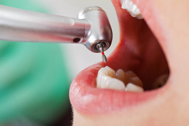Best Cracked Tooth Emergency Dentist  in Morganton, NC